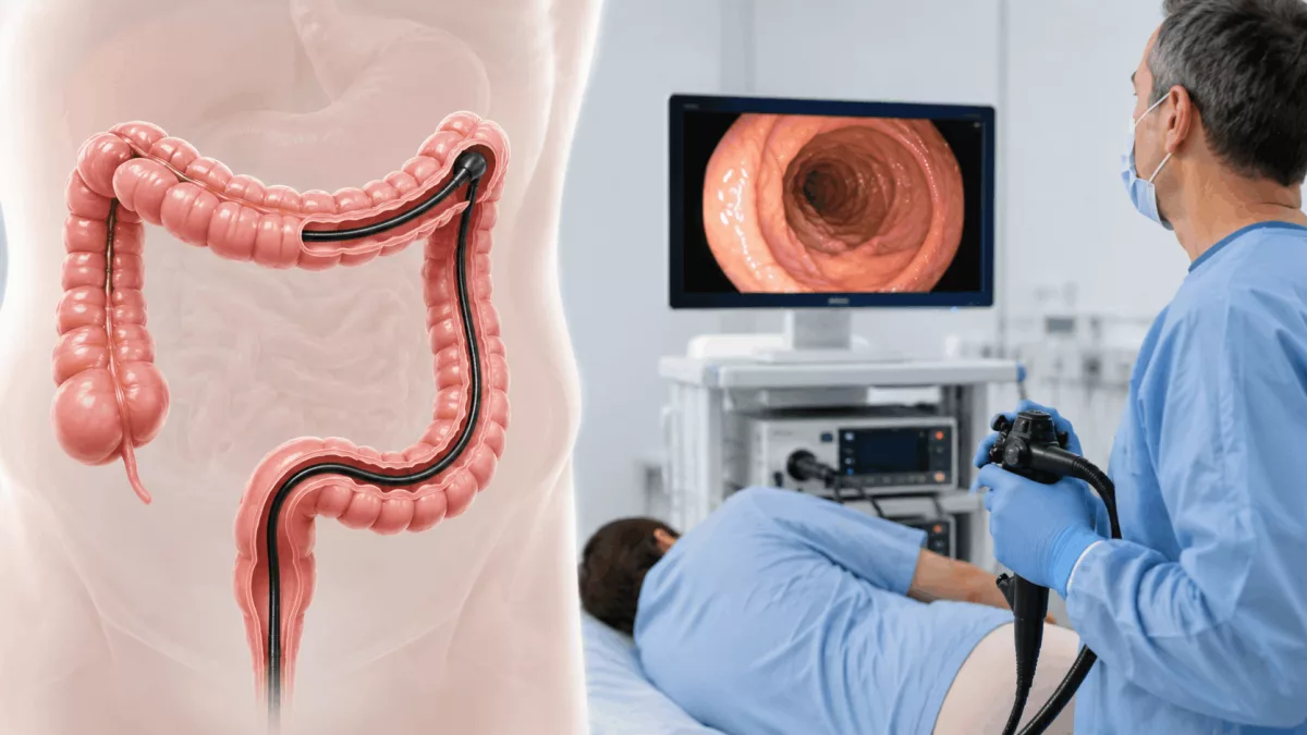 colonoscopia anatomia colon procedimiento